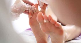 How to prevent ingrown toenails?